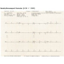 Econet Cardio-M Plus, 12-Kanal EKG inkl. Interpretation und Farb-Touchscreen
